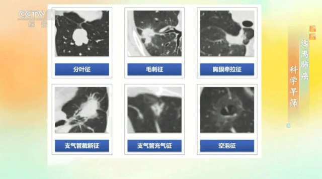 2人被抓！2026高速免费时间公布！肺结节小心拖成癌冰球突破
